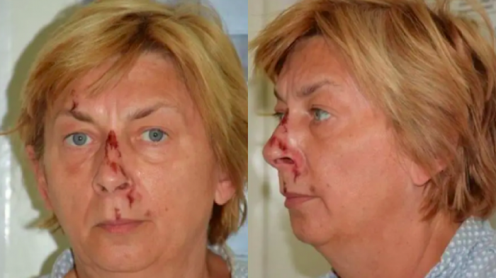 No recuerda nada: Mujer fue encontrada con vida en una isla donde habitan jabalíes y osos