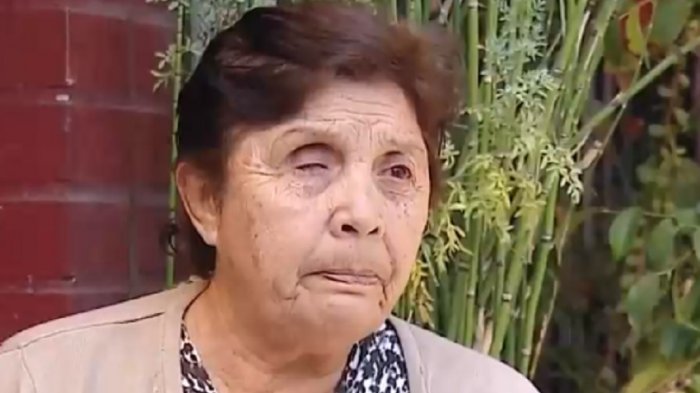 Paciente que perdió un ojo en operación y demandó al hospital recibirá indemnización de $50 millones