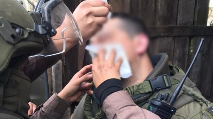 La Araucanía: Carabinero recibió impacto de perdigón en su rostro durante emboscada en Victoria