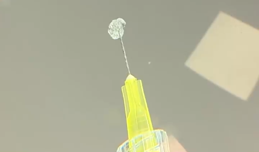 Alerta por masiva venta de ácido hialurónico en internet