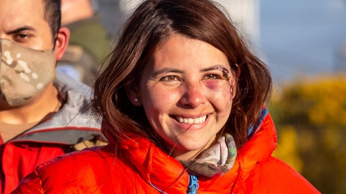 Enfermera desaparecida en Puerto Varas sobrevivió comiendo raíces de plantas y bebiendo agua de riachuelo