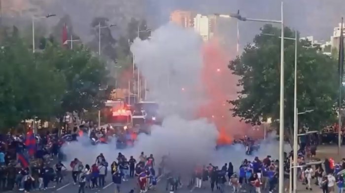 Hincha de la U herido por explosión de fuego artificial habría perdido un ojo y sigue en riesgo vital