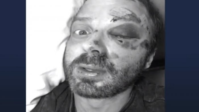 Javier Fernández sufre caída en bicicleta y asegura que venía fallada: 