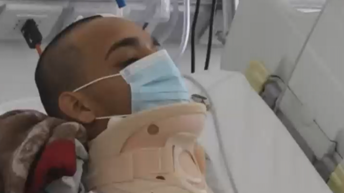 Amputaron su pierna: Motociclista grave tras impacto de auto que no respetó el disco pare en Santiago