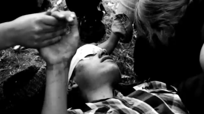 Hecho ocurrió en 2015: Víctima de trauma ocular por bomba lacrimógena pide justicia