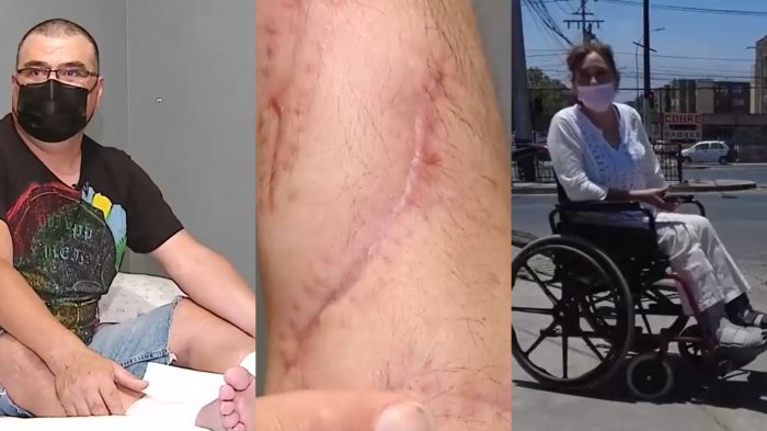 En aniversario de 18-O: Víctimas embestidas por auto con alambres de púa siguen sin justicia