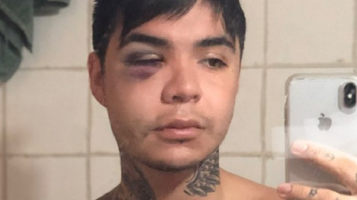 Leo Méndez denuncia fallida cirugía en Chile: 