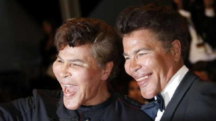 No se vacunaron: Populares gemelos franceses murieron de COVID-19 con seis días de diferencia