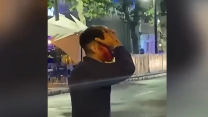 Denuncian agresión de guardias de un local en Barrio Bellavista: Más personas dicen haber vivido un caso similar