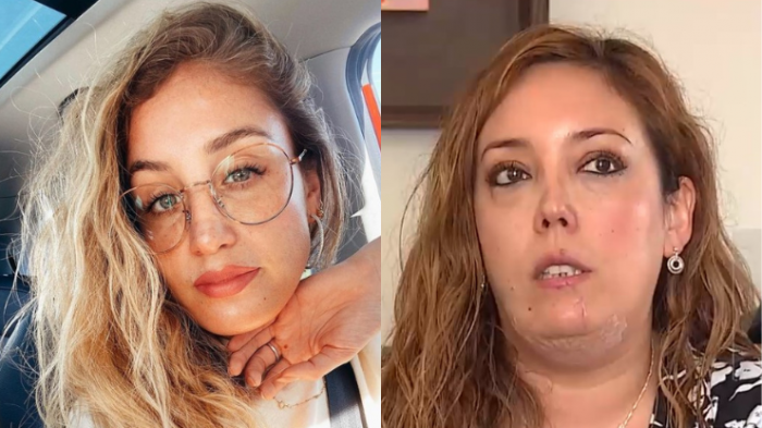 Daniela Castro responde a denuncia de mujer mordida por su perro: 