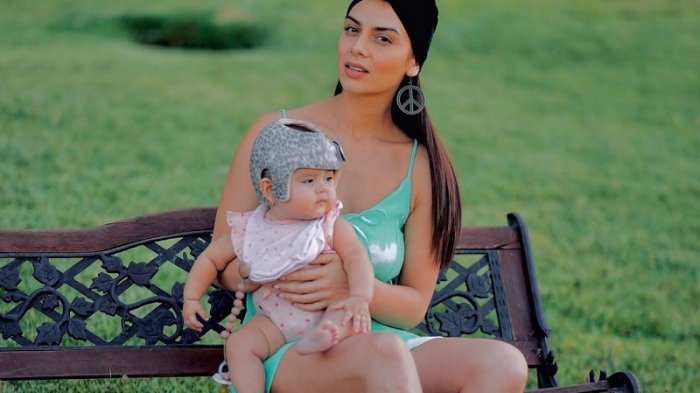 Kathy Contreras explica por qué su hija de 7 meses debe ocupar un casco ortopédico: Tiene dos patologías