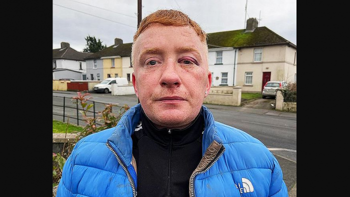 Hombre llevó a su tío fallecido a cobrar la pensión: 