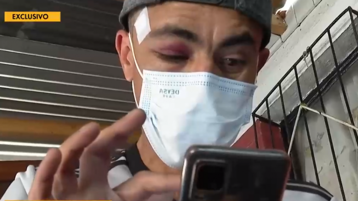 Habla hombre que asegura haber recibido un balín por parte de dueño de ex Fuente Alemana