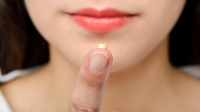 “De nuevo se vulneran los derechos sexuales de las mujeres”: Colegio de Matronas critica nueva falla en anticonceptivos