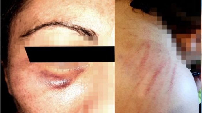 Independencia: Denuncian ataque a pareja lésbica y a sus mascotas con golpes de pies, puños y palos