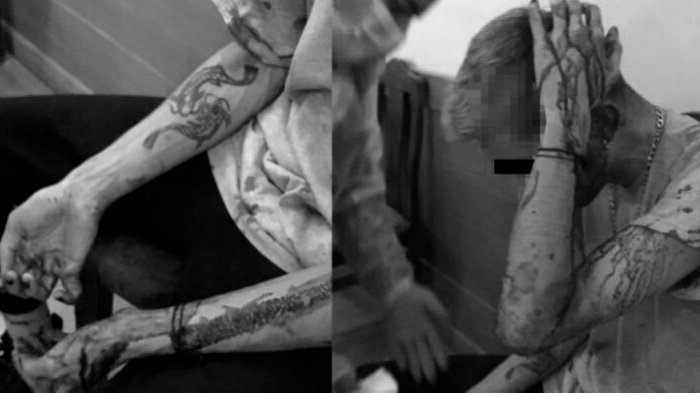 Golpes de puños y patadas: Movilh denuncia violento ataque homo transfóbico a jóvenes en restaurante de Providencia