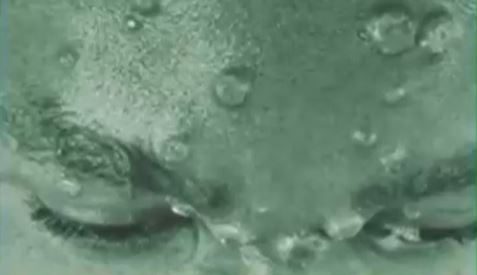 Viruela del mono: Infectóloga detalla cómo se transmite y sus riesgos