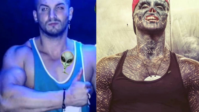 Hombre asegura que quiere ser un alien negro: Ahora busca amputarse la pierna