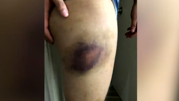 Absuelven a siete carabineros acusados de tortura durante el estallido social