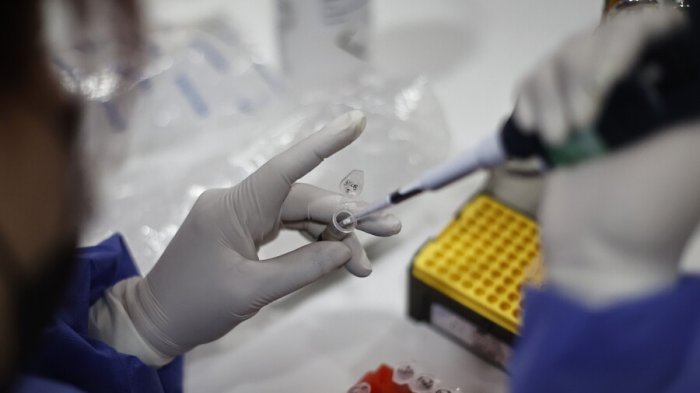 Reportan 55 casos de viruela del mono en Chile: El 100% corresponde a hombres entre 20 y 54 años