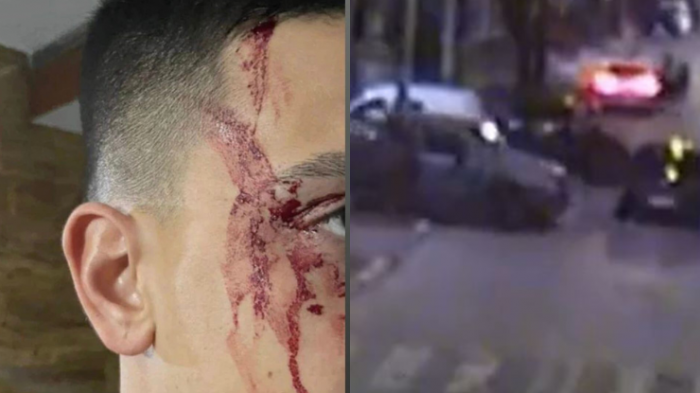 Terminó con el rostro ensangrentado: Futbolista de Boca Juniors sufrió violenta encerrona a metros de su casa