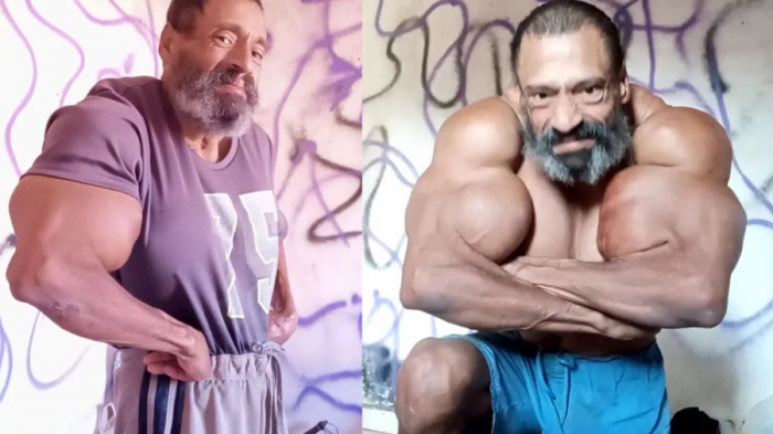 Presentó dificultad al respirar: Fisicoculturista habría muerto al inyectarse una sustancia para los músculos