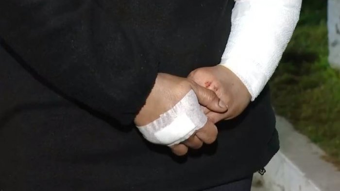 Niña de 5 años en riesgo vital tras ser mordida por dos perros rottweiler en La Reina