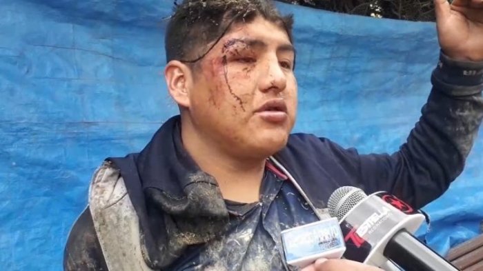 Sujeto salió de fiesta y despertó bajo tierra en un ataúd: Amigos lo querían como símbolo de sacrificio