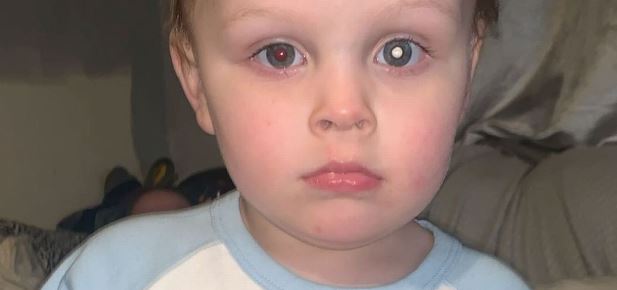 Madre notó extraño color en el ojo de su guagua tras una foto con flash: Le diagnosticaron cáncer