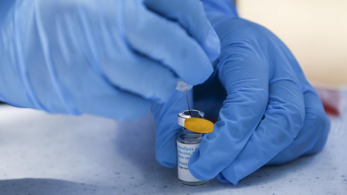 Caso inédito en el mundo: Hombre dio positivo simultáneamente a viruela del mono, COVID-19 y VIH