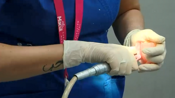 Hay más de 50 denuncias en el Sernac: Acusan a clínica dental de Providencia por tratamientos inconclusos