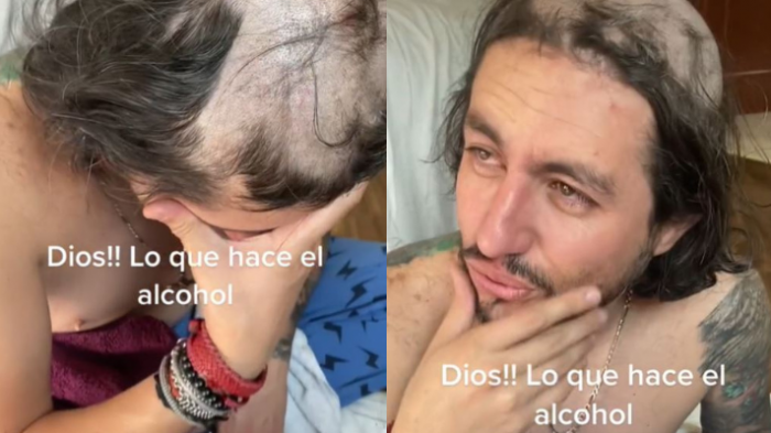 Hijos aprovecharon que su padre dormía tras beber alcohol y le hicieron el peor corte de pelo