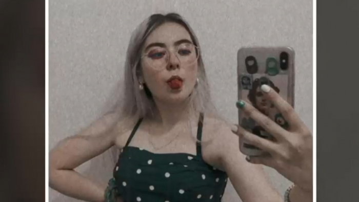 Padece fibrosis quística: Familia busca desesperadamente un donante para joven de 19 años