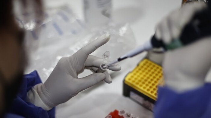 Llegó a Chile el primer cargamento con vacunas contra la viruela del mono