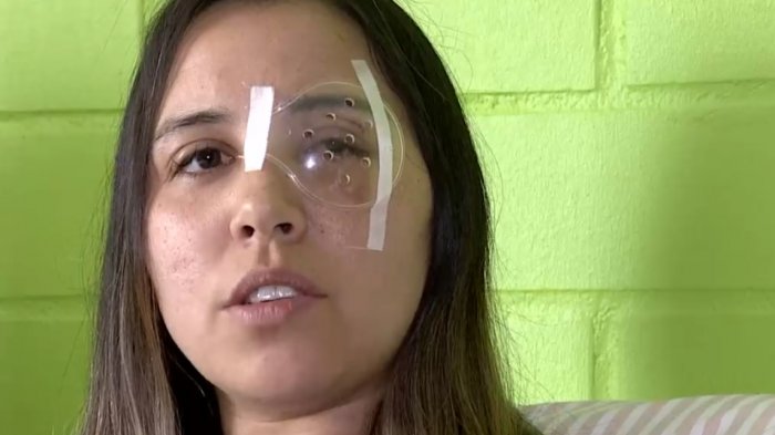 El dramático relato de mujer tras ataque con piedra en auto: 