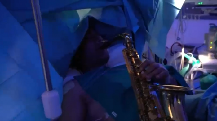 Emotivo registro: Músico italiano se viralizó tras tocar el saxofón en medio de cirugía cerebral
