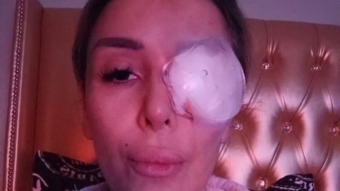 El delicado estado de salud de ex chica Mekano a meses de haber sufrido brutal golpiza