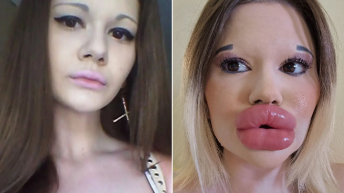 Médico le pidió que pare: Impacto por joven que busca tener 