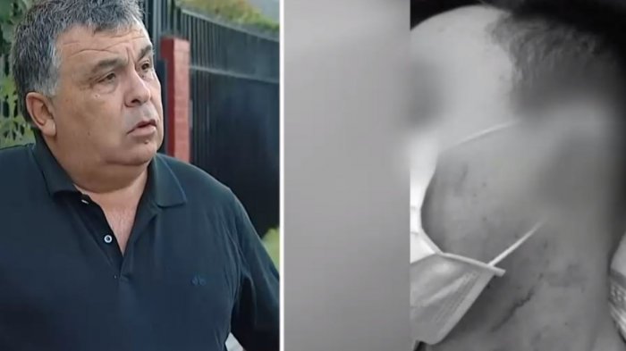 Joven en riesgo vital tras brutal golpiza en discoteque de Las Condes: Lo atacaron con un fierro en la cabeza