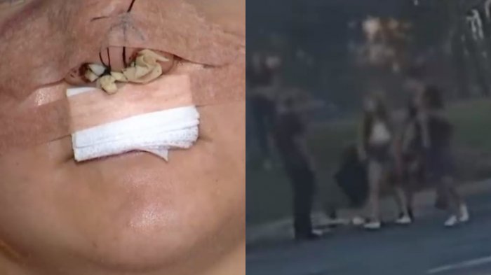 Todo por un celular: Adolescente sufrió brutal asalto en Maipú a manos de banda de menores de edad