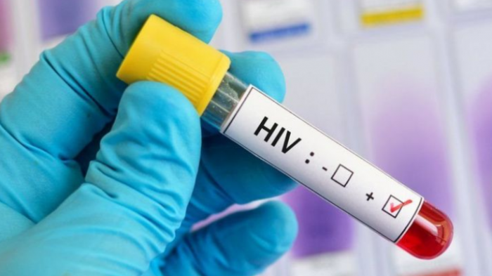 Estudio de vacuna contra VIH es cancelado en etapa final por Janssen