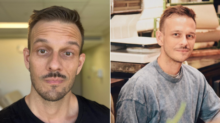 Luis Larraín confirma diagnóstico de cáncer de sangre tras hospitalización por derrame pleural