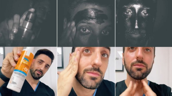 Cosmetólogo probó eficacia de protector solar frente a cámara UV: Así es el antes y después de usarlo