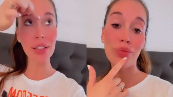 Vale Roth mostró todos los retoques estéticos que tiene su cara: 