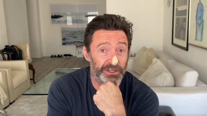 Hugh Jackman se sometió a dos biopsias por riesgo de cáncer de piel: 