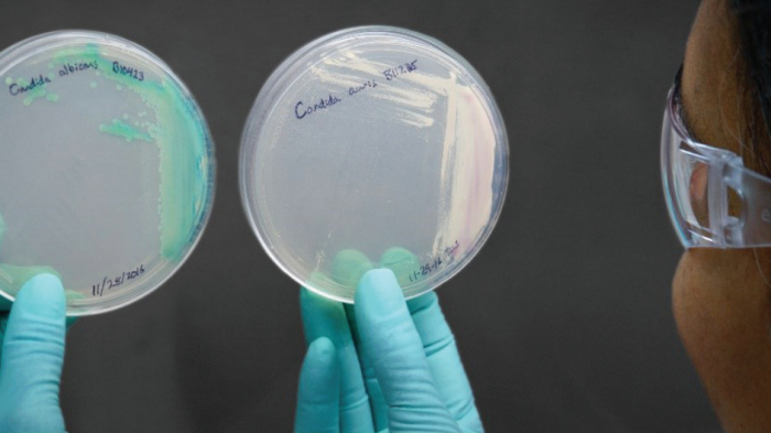 Qué es Candida auris, el hongo considerado una 