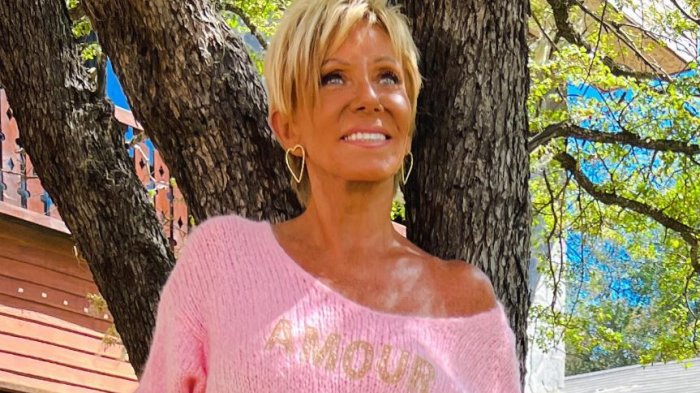 Raquel Argandoña reveló los detalles de su rejuvenecimiento facial: 