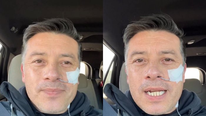 Leandro Martínez preocupó al aparecer con sonda en la nariz y contó que se sometió a complejo examen