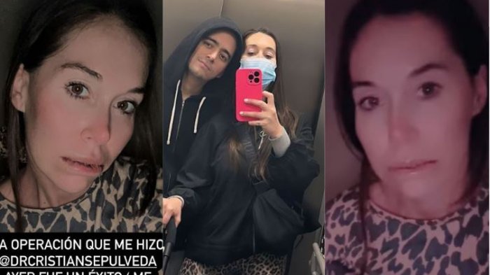 “Me daba vergüenza y pudor mostrar...”: Vale Roth reveló grave problema de salud que la obligó a operarse