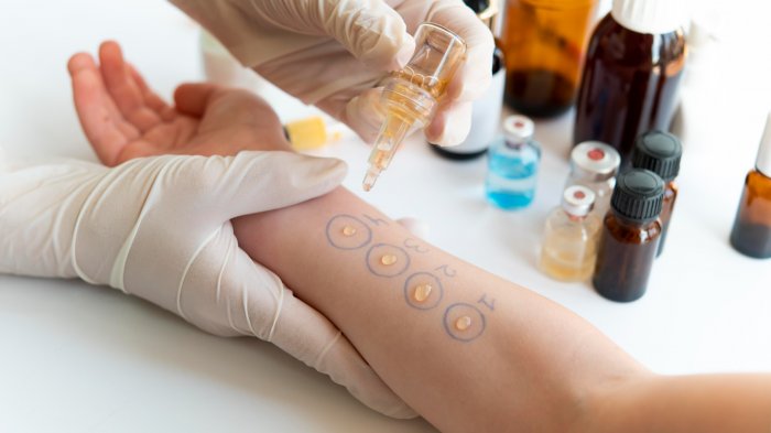 OMS estimó que casi la mitad del mundo será alérgica en 2050